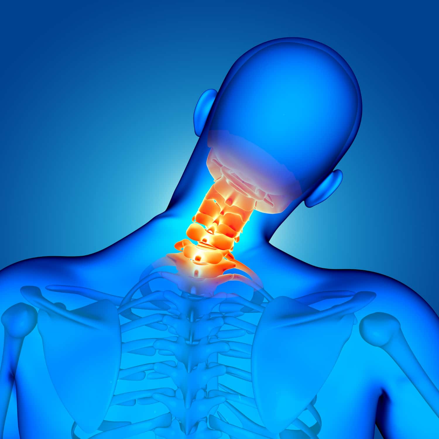 Neck and Back Injury Attorney