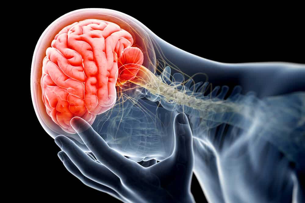Brain Injuries after Accidents