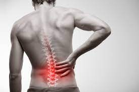 Negligent Spine Injury