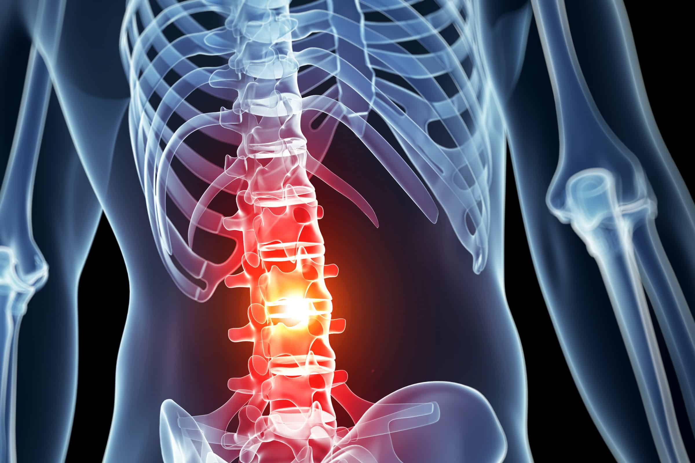 Spine Injury Claims